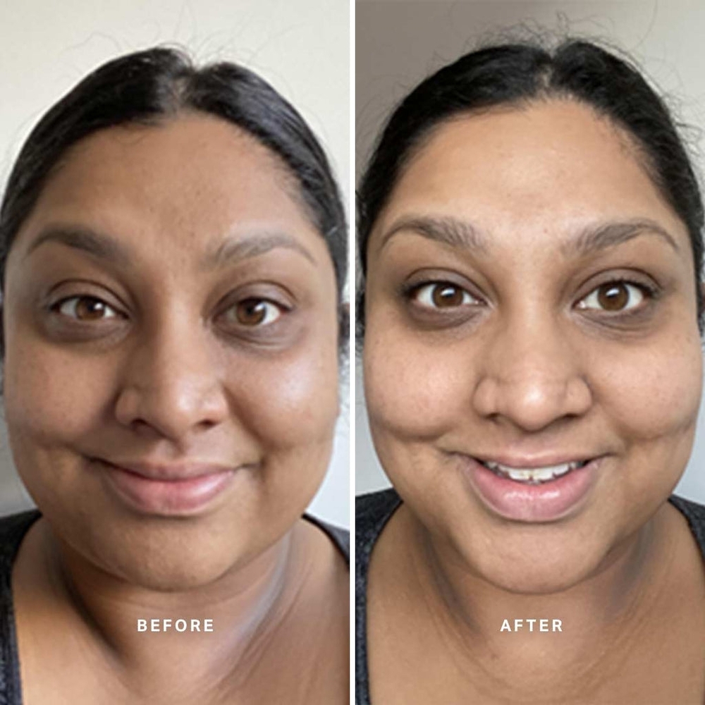 🆕️✨️Alpha-H Liquid Gold with Glycolic Acid - Picture 3 of 16